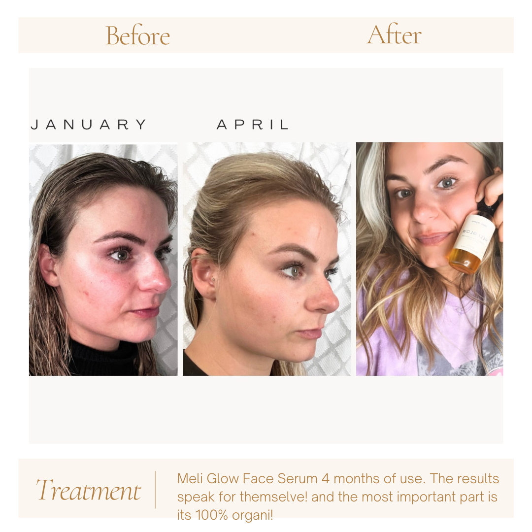 Méli Glow Anti-aging Face & Body Serum PH Design Organics