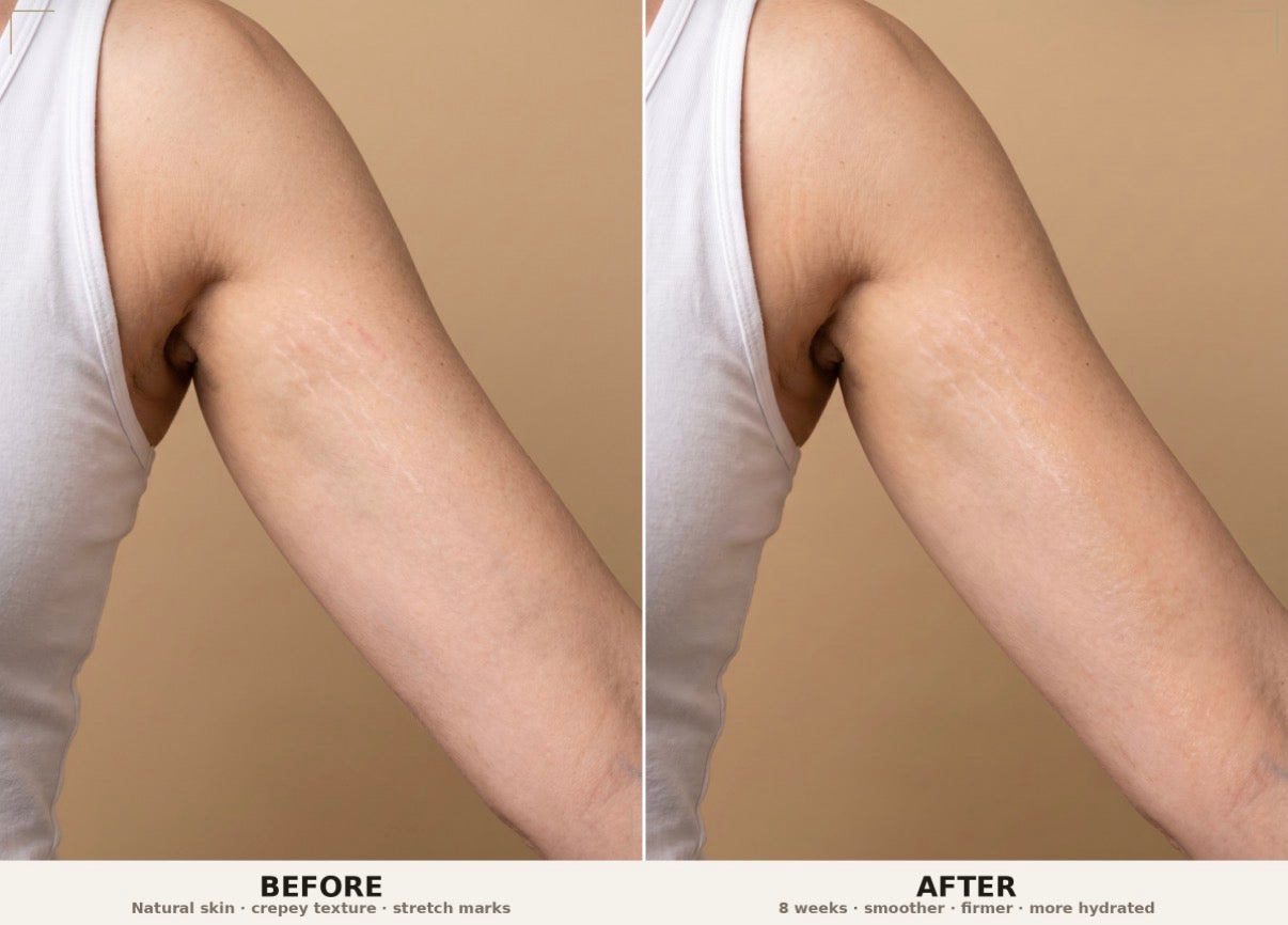 Firm and Fade Cream For Stretch Marks &amp; Tight Skin | PH Design Organics
