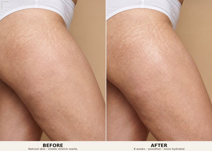 Firm and Fade Cream For Stretch Marks &amp; Tight Skin | PH Design Organics
