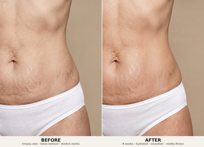 Firm and Fade Cream For Stretch Marks &amp; Tight Skin | PH Design Organics