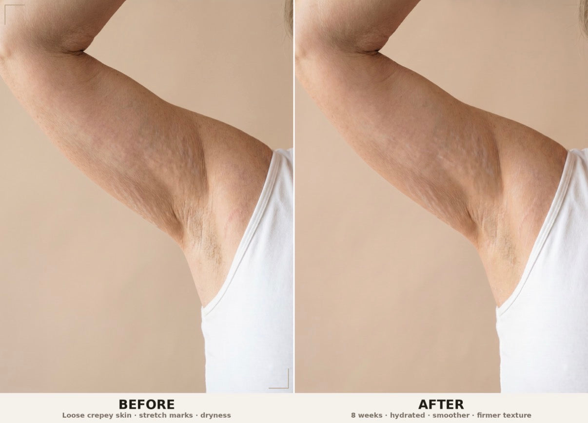 Firm and Fade Cream For Stretch Marks &amp; Tight Skin | PH Design Organics