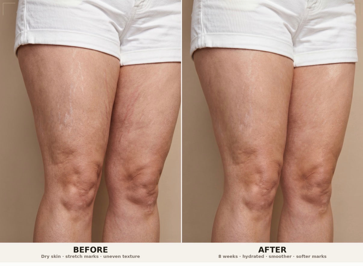 Firm and Fade Cream For Stretch Marks &amp; Tight Skin | PH Design Organics