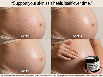 Firm and Fade Cream For Stretch Marks &amp; Tight Skin | PH Design Organics